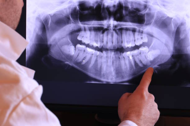 Best Emergency Treatment for Dental Infections or Abscesses in Genoa City, WI