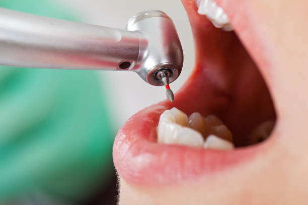 Best Emergency Tooth Extraction in Genoa City, WI
